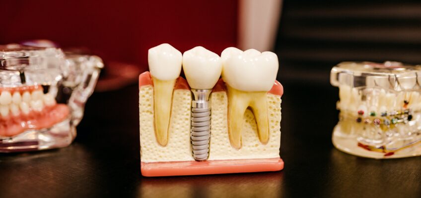 Tampil dengan Senyum