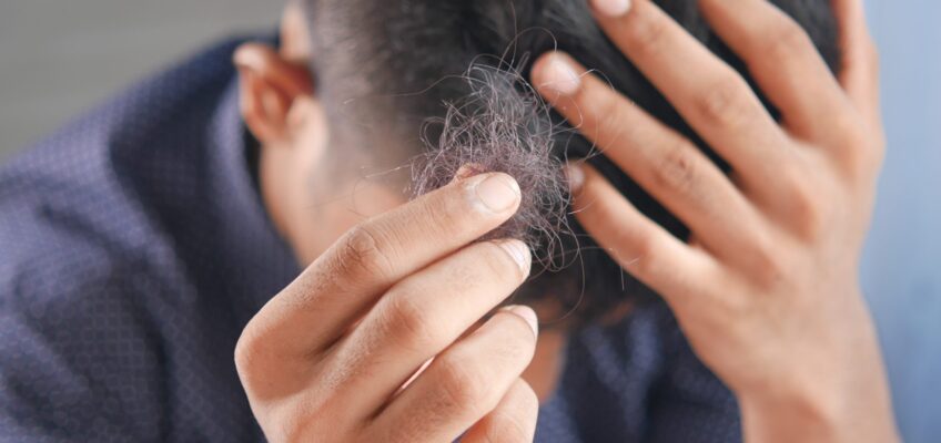 Panduan untuk Rambut Rontok